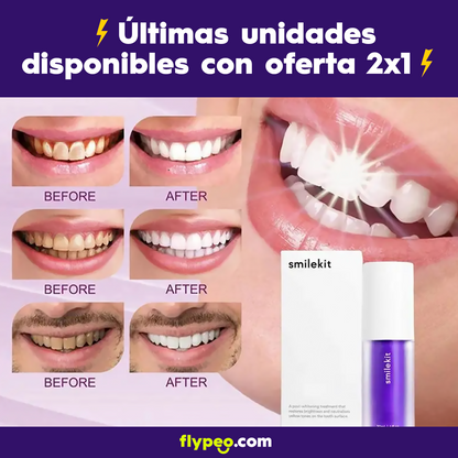 V34 Blanqueador Dental: La Revolución para una Sonrisa Radiante al Instante